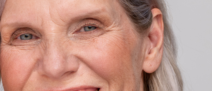 Pigmentflecken im Gesicht entfernen