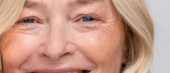 Was sind Pigmentflecken?